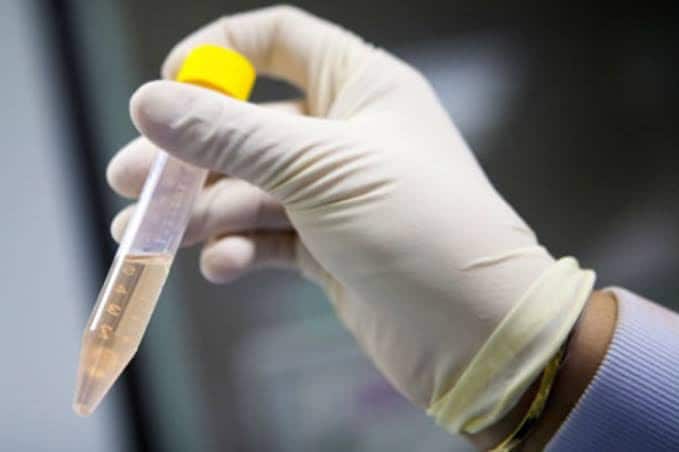 ब्रिटनमध्ये यावर संशोधन झालं असून कॅन्सर होण्याआधीच 5 वर्ष त्याचं निदान करता येऊ शकतं अशी 'ब्लड टेस्ट' शोधण्यात आली आहे. या संशोधनासाठी आणखी निधीची गरज असून तो निधी मिळाला तर लवकरच हे संशोधन पूर्ण होणार आहे. ब्रिटनमध्ये यावर संशोधन झालं असून कॅन्सर होण्याआधीच 5 वर्ष त्याचं निदान करता येऊ शकतं अशी 'ब्लड टेस्ट' शोधण्यात आली आहे. या संशोधनासाठी आणखी निधीची गरज असून तो निधी मिळाला तर लवकरच हे संशोधन पूर्ण होणार आहे.