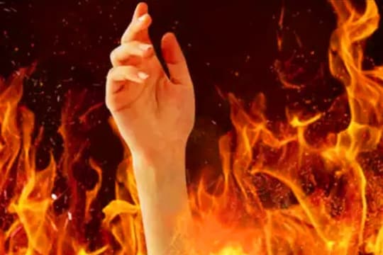 मंडपाऐवजी पोहचली ICUमध्ये, लग्नाच्या 3 दिवस आधी मुलीला डिझेल ओतून पेटवलं