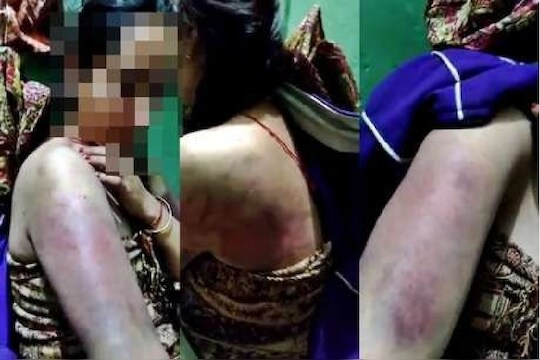 विकृतीचा कळस! लग्नाच्या पहिल्या वाढदिवसाला लाडक्या पत्नीला बेदम मारहाण, मन सुन्न करणारा VIDEO