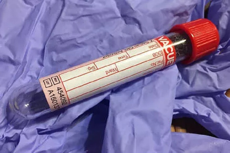 Coronavirus च्या निदानासाठी लवकरच ब्लड टेस्ट, भारतातील रुग्णांचा खरा आकडा समजणार