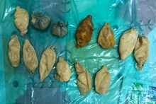 13 कंडोममध्ये ड्रग्स भरून लपवले होते प्राईव्हट पार्टमध्ये, अधिकाऱ्यांनी पकडलेच!