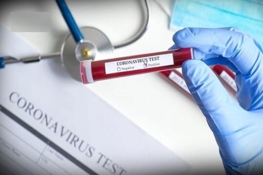 गुढीपाडव्याच्या मुहूर्तावर पुणेकरांना गुड न्यूज, 5 जणांनी केली कोरोनावर मात