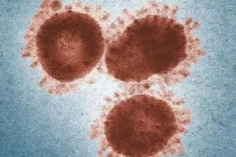 मुंबई, पुणे, नागपूर, अहमदनगरपाठोपाठ आता यवतमाळमध्येही (yavatmal) कोरोनाव्हायरस पोहोचला आहे. त्यामुळे राज्यात (Maharashtra) आता कोरोनाव्हायरसचे (Coronavirus) एकूण 22 रुग्ण आहेत.