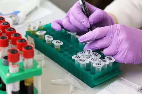 पिंपरी चिंचवडकरांसाठी दिलासा, कोरोनासंदर्भात समोर आला मोठा अहवाल corona in pune 278 patient reports are negative in pimpri chinchwad | Coronavirus-latest-news - News18 Lokmat, Today's Latest ...