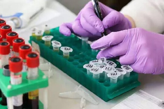 पुण्यात पॉझिटिव्ह रुग्णांची एकूण संख्या ही 57523 एवढी झाली आहे. तर 18040 जण सक्रिय रुग्ण आहेत.