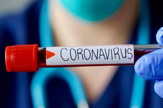 आतापर्यंत गुजरातमध्ये 8,903 कोरोनारुग्ण सापडले आहेत. त्यापैकी 3,246 रुग्ण बरे झाले आहेत. तर 537 जणांचा जीव कोरोनाव्हायरसमुळे गेला आहे.