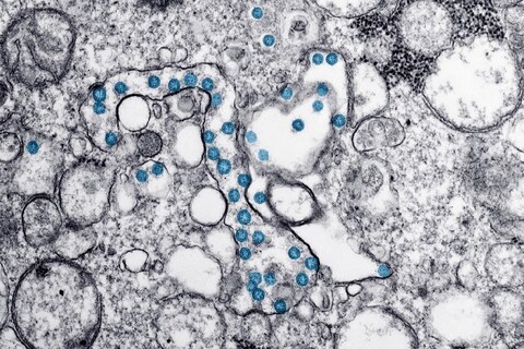 चीनमध्ये (china) कोरोनाव्हायरसने (coronavirus) थैमान घातल्यानंतर जगभरातील शास्त्रज्ञांनी त्याच्यावर अभ्यास सुरू केला होता.