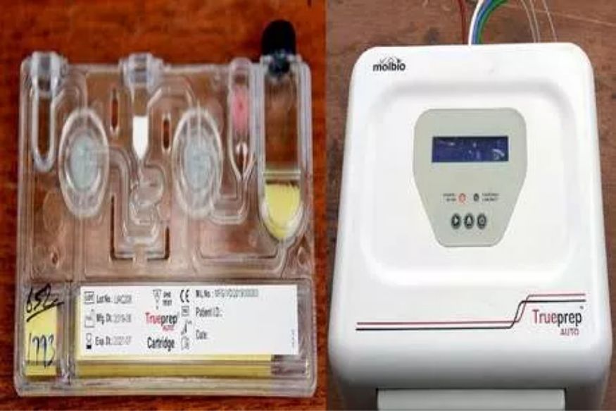 लढा जिंकूच! ‘या’ राज्याने तयार केली Covid-19 किट, अवघ्या 55 मिनिटांत लागणार कोरोनाचा निकाल