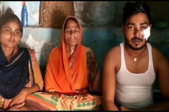 लॉकडाऊनमध्ये पोलिसाने केलेल्या मारहाणीत तरुणाला आलं अंधत्व, सरकारकडून करतोय न्यायाची मागणी