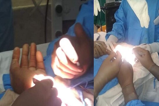 हल्लेखोरांनी कापला पोलिसाचा हात, डॉक्टरांनी साडेसात तास शस्त्रक्रिया करून जोडला