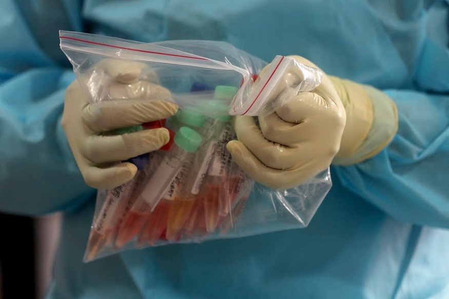 A doctor holds a plastic bag full of swab specimen collected from journalists during lockdown to control the spread of the new coronavirus in Mumbai, India, Thursday, April 16, 2020. Indian Prime Minister Narendra Modi on Tuesday extended the world's largest coronavirus lockdown to head off the epidemic's peak, with officials racing to make up for lost time. (AP Photo/Rafiq Maqbool)