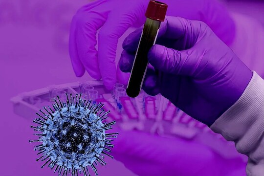कोरोना विरुद्ध भारताच्या Hydroxychloroquine या औषधाला जगभरात मागणी, त्याचं हे आहे कारण
