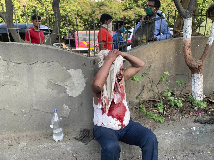 ट्रकचा अपघात होऊन डोक्याला जबर मार लागल्यानंतर या इसमाला रक्त थांबण्यासाठी साध्या कपड्याचा आधार घ्यावा लागला (फोटो सौजन्य-एपी) ट्रकचा अपघात होऊन डोक्याला जबर मार लागल्यानंतर या इसमाला रक्त थांबण्यासाठी साध्या कपड्याचा आधार घ्यावा लागला (फोटो सौजन्य-एपी)