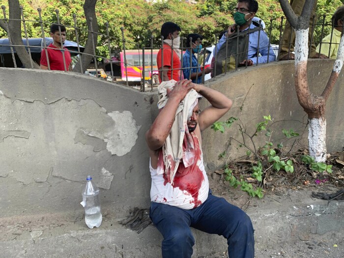 ट्रकचा अपघात होऊन डोक्याला जबर मार लागल्यानंतर या इसमाला रक्त थांबण्यासाठी साध्या कपड्याचा आधार घ्यावा लागला (फोटो सौजन्य-एपी)