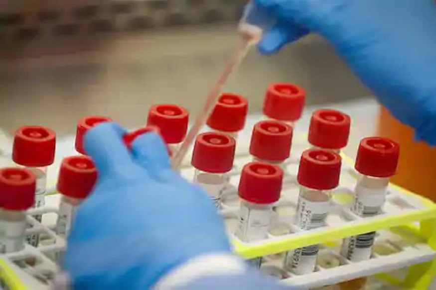 रशियाच्या शास्त्रज्ञांनी संरक्षण मंत्रालयाच्या मदतीने ही लस तयार केली आहे.