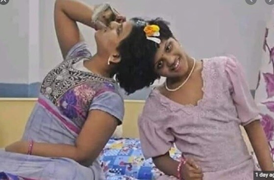 या वर्षी दहावीच्या परीक्षेला बसताना त्यांनी वेगवेगळे पेपर लिहिण्याची इच्छा व्यक्त केली. तेलंगण सरकारने त्यांना एकाच परीक्षा केंद्रावर पण वेगवेगळ्या कक्षातले हॉल तिकिट दिले. या वर्षी दहावीच्या परीक्षेला बसताना त्यांनी वेगवेगळे पेपर लिहिण्याची इच्छा व्यक्त केली. तेलंगण सरकारने त्यांना एकाच परीक्षा केंद्रावर पण वेगवेगळ्या कक्षातले हॉल तिकिट दिले.