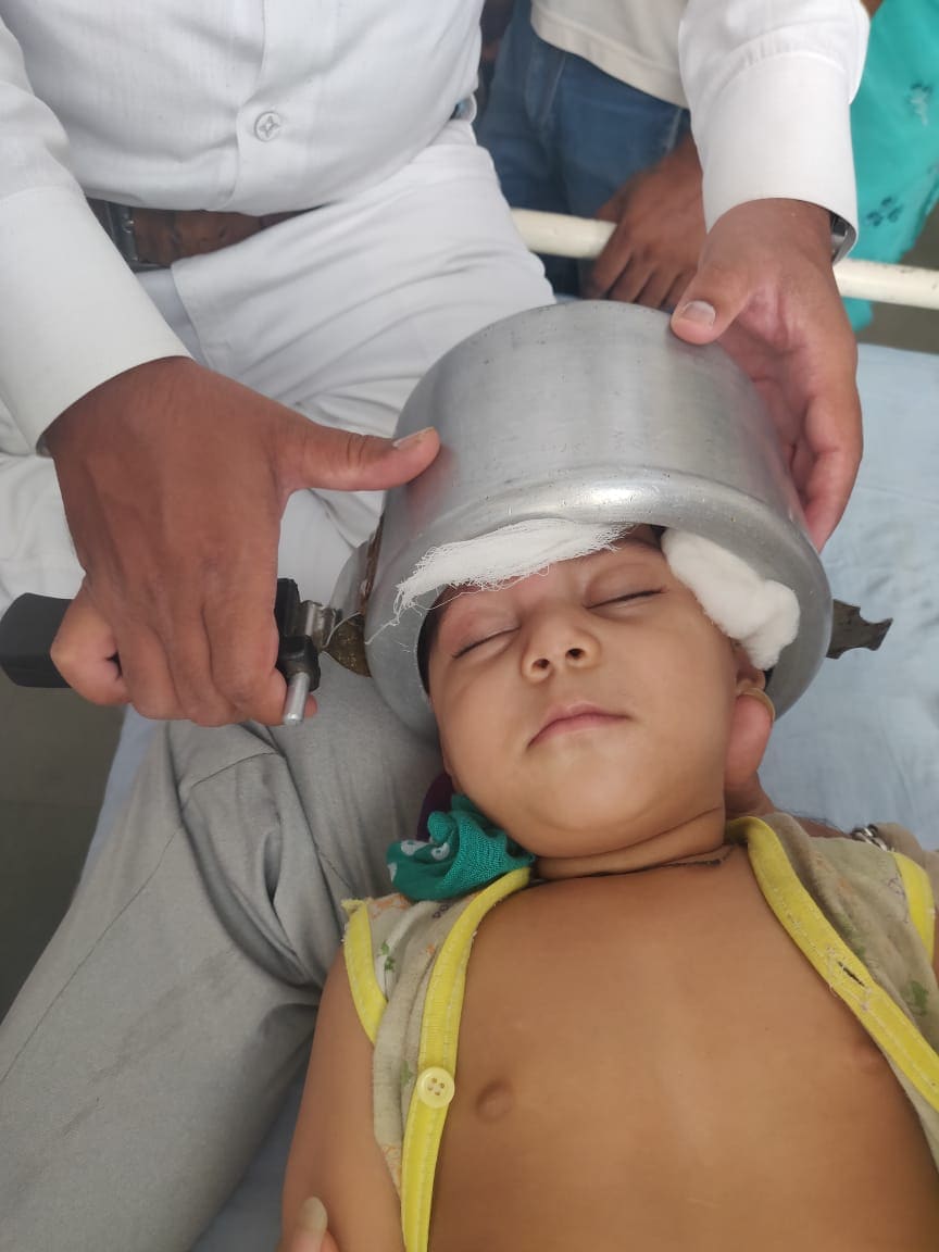 या फोटो पाहिल्यानंतर काय घडलं असावं याचा तुम्हाला अंदाज आलाच असेल. खेळता खेळता एका लहान मुलाने डोक्यात प्रेशर कुकर घातल्याची घटना समोर आली आहे. या फोटो पाहिल्यानंतर काय घडलं असावं याचा तुम्हाला अंदाज आलाच असेल. खेळता खेळता एका लहान मुलाने डोक्यात प्रेशर कुकर घातल्याची घटना समोर आली आहे.