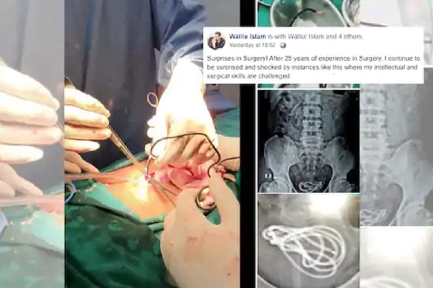 धक्कादायक! डॉक्टरांना मूत्राशयात सापडली केबल; मोबाइल चार्जरने हस्तमैथुन केल्याचा प्रताप