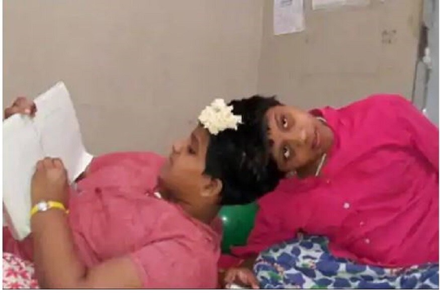 10 कोटी रुपये खर्चून अत्यंत गुंतागुंतीची शस्त्रक्रिया करण्याचा त्यांना सल्ला देण्यात आला होता. पण मेंदूतल्या बारिक पेशी आणि रक्तवाहिन्या गुंतल्यामुळे हे ऑपरेशन जीवघेणं ठरू शकलं असतं. 10 कोटी रुपये खर्चून अत्यंत गुंतागुंतीची शस्त्रक्रिया करण्याचा त्यांना सल्ला देण्यात आला होता. पण मेंदूतल्या बारिक पेशी आणि रक्तवाहिन्या गुंतल्यामुळे हे ऑपरेशन जीवघेणं ठरू शकलं असतं.