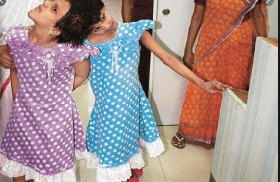 वीणा आणि वाणी यांच्या आई-वडिलांनी शेवटी मुलींना आहे त्या अवस्थेतच स्वीकारलं आणि त्यांना सर्वसामान्य जीवन जगण्यासाठी प्रयत्न केले. वीणा आणि वाणी यांच्या आई-वडिलांनी शेवटी मुलींना आहे त्या अवस्थेतच स्वीकारलं आणि त्यांना सर्वसामान्य जीवन जगण्यासाठी प्रयत्न केले.