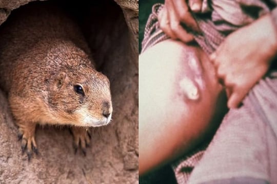 Bubonic plague: कोरोनानंतर ब्यूबॉनिक प्लेगवरून चीनला पाठीशी घालतंय WHO? दिली अजब प्रतिक्रीया