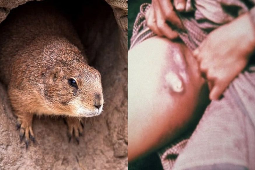 Bubonic plague: चीननंतर आता अमेरिकेतही सापडलं भयंकर ब्यूबॉनिक प्लेगचं एक प्रकरण