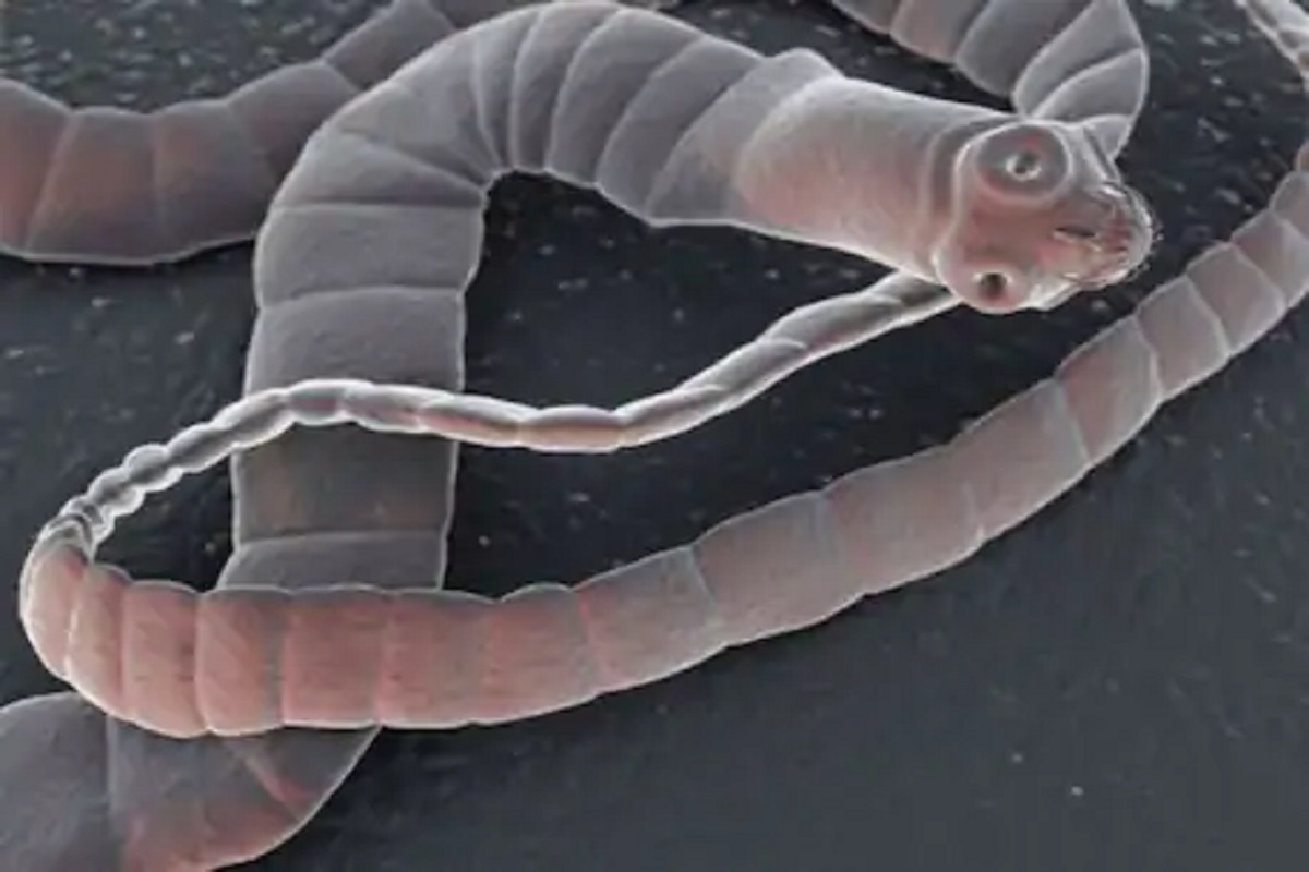 बापरे! 17 वर्षांपासून तरुणाच्या डोक्यात वळवळत होता 5 इंचाचा किडा, डॉक्टरही झाले हैराण