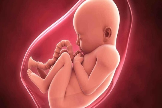 प्रेग्नन्सीत दुर्लक्षपणा बाळाला स्पायना बायफिडा होण्यास ठरू शकतो कारणीभूत