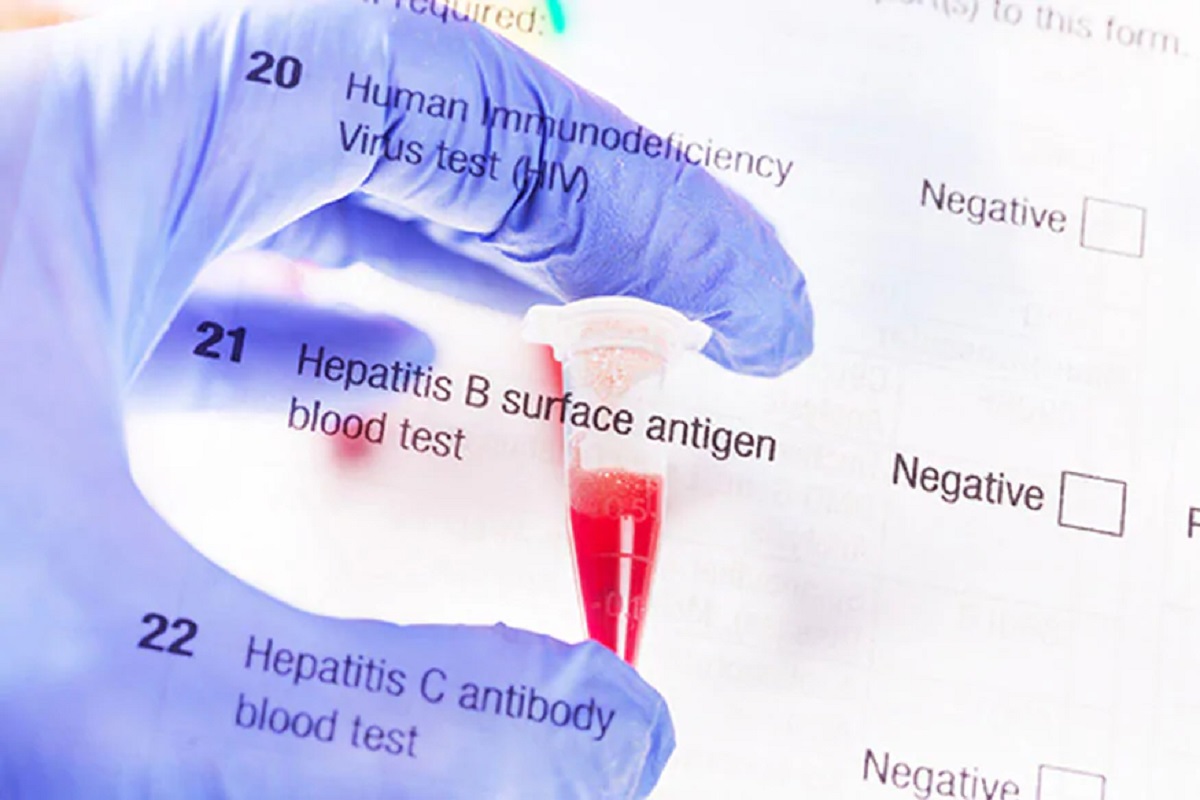 वेळीच निदान न झाल्यास हेपेटायटिस घेईल यकृत कॅन्सरचं रूप; वेळीच ओळखा लक्षणं