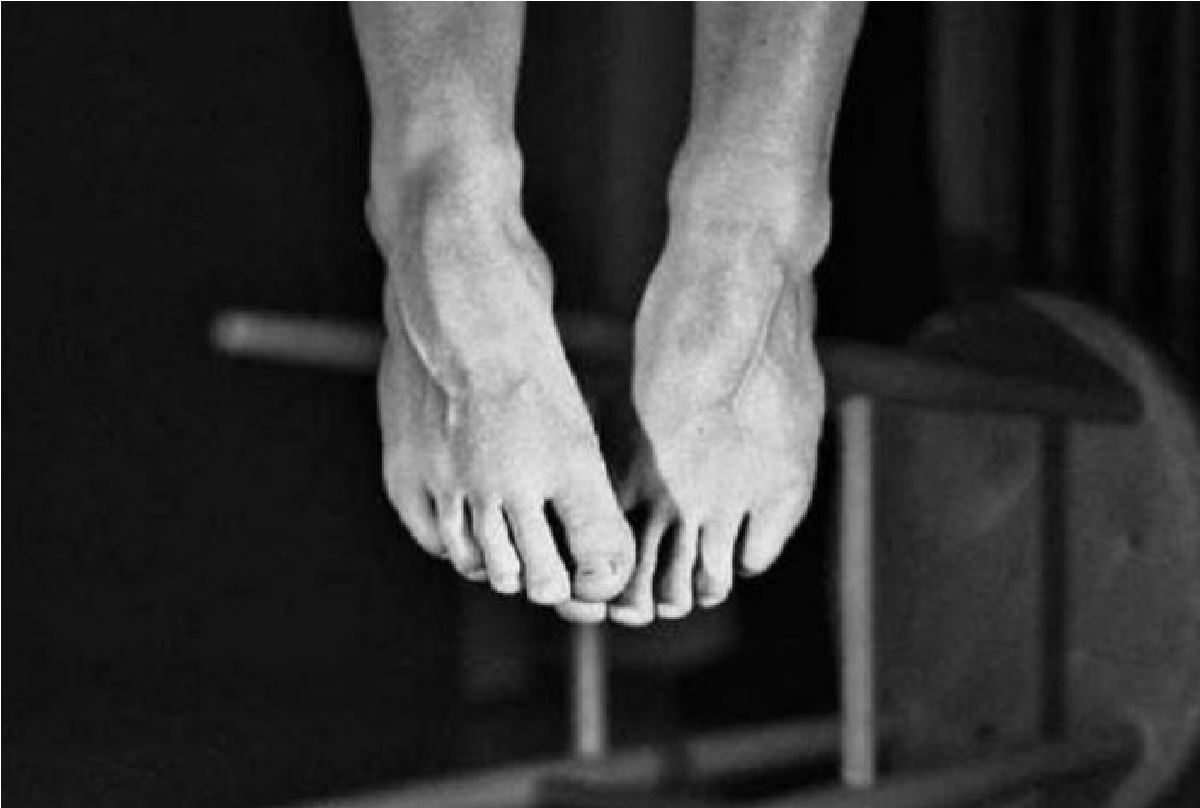 जरा बारकाईने अभ्यास केला तर देशात आत्महत्येचं प्रमाण वाढतं आहे. यावर आता सरकारनेही गांभीर्याने विचार करण्यास सुरुवात केली आहे. त्यासाठी काही कठोर पाऊलंही उचलली जात आहेत. बीबीसीने दिलेल्या वृत्तानुसार, 2018 मध्ये मंजूर केला गेलेला मेंटल हेल्थकेअर कायदा 2017 (Mental Healthcare Act, 2017) हा भारतात आत्महत्येचे प्रकार संपवून मानसिक आजारांनी ग्रस्त असलेल्या लोकांना मोफत मदत पुरवण्यासाठी आखण्यात आला आहे.