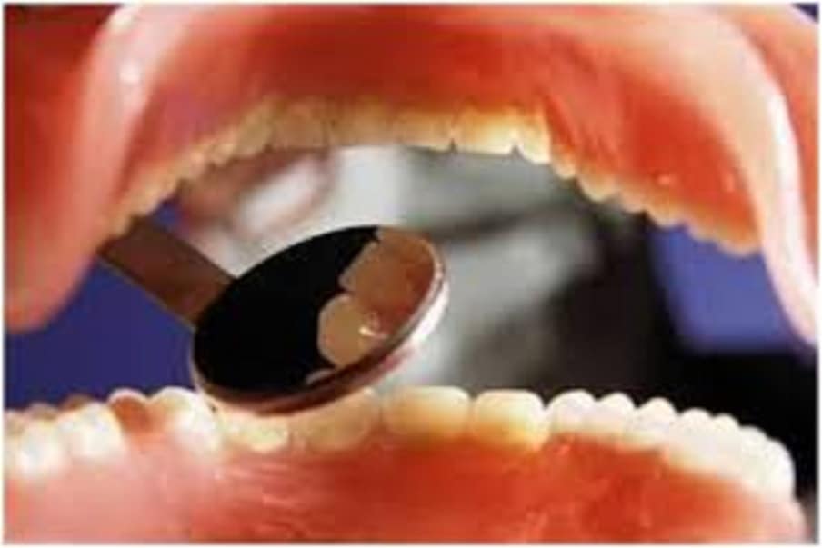 तज्ज्ञांच्या मते, दोन दातांमध्ये गॅप असण्याची समस्या दात आणि जबड्याच्या आकारावर अवलंबून असते. जर एखाद्या व्यक्तीचा जबडा मोठा असेल आणि दातांचा आकार लहान असेल तर 2 दातांमध्ये गॅप येऊ शकतो.
