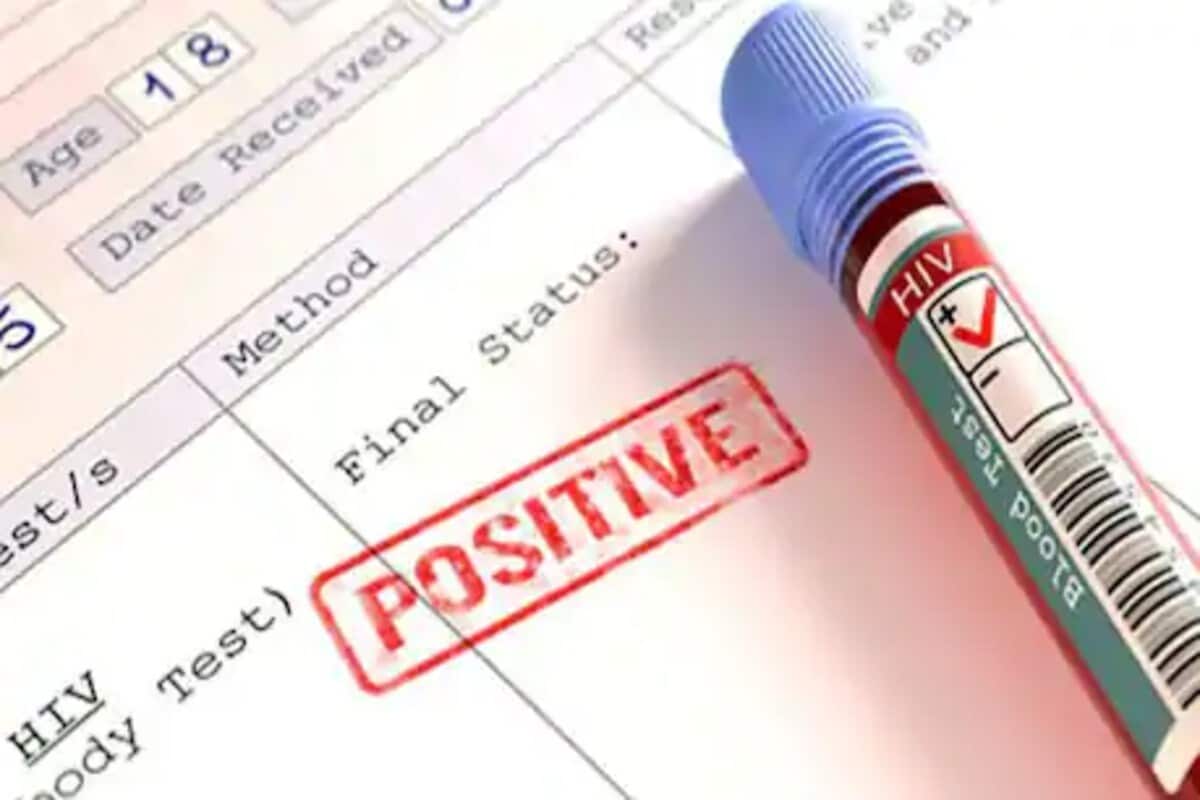 26 ऑगस्ट रोजी सायन्स मॅगझिन नेचरमध्ये प्रकाशित रिपोर्टनुसार या रुग्णाच्या शरीरात HIV चा सक्रिय व्हायरस नाही. याचा अर्थ ही व्यक्ती HIV ने संक्रमित झाली आणि आपोआप बरीदेखली झाली. जेव्हा हे प्रकरण समोर आलं तेव्हा डॉक्टरांनी त्याच्या शरीरातील 150 कोटी पेशींची तपासणी केली. या रुग्णाला EC2 असं नाव देण्यात आलं होतं. 26 ऑगस्ट रोजी सायन्स मॅगझिन नेचरमध्ये प्रकाशित रिपोर्टनुसार या रुग्णाच्या शरीरात HIV चा सक्रिय व्हायरस नाही. याचा अर्थ ही व्यक्ती HIV ने संक्रमित झाली आणि आपोआप बरीदेखली झाली. जेव्हा हे प्रकरण समोर आलं तेव्हा डॉक्टरांनी त्याच्या शरीरातील 150 कोटी पेशींची तपासणी केली. या रुग्णाला EC2 असं नाव देण्यात आलं होतं.