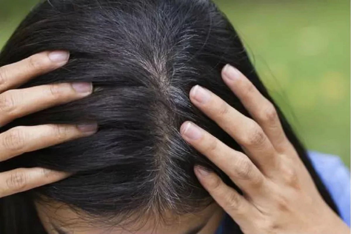 ना हेअर डाय, ना आर्टिफिशिअल कलर; फक्त तेलानं मालिश करून काळे करा केस