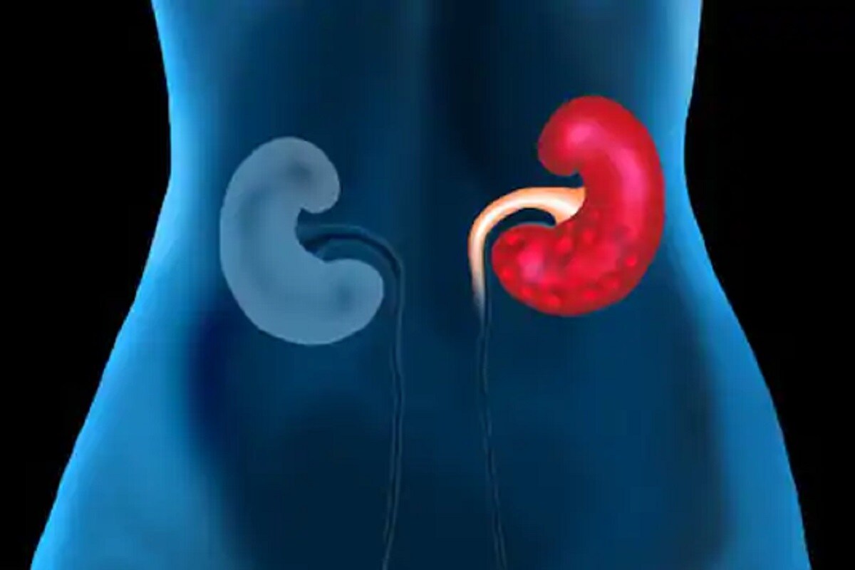 गुजरातच्या अहमदाबादमधील डिसीज अँड रिसर्च सेंटर ऑफ द इन्स्टिट्युट ऑफ किडनीने कुटुंबाअंतर्गत होणाऱ्या अवयवदान आणि अवयव प्रत्यारोपणाबाबत अभ्यास करण्यात आला. गुजरातच्या अहमदाबादमधील डिसीज अँड रिसर्च सेंटर ऑफ द इन्स्टिट्युट ऑफ किडनीने कुटुंबाअंतर्गत होणाऱ्या अवयवदान आणि अवयव प्रत्यारोपणाबाबत अभ्यास करण्यात आला.