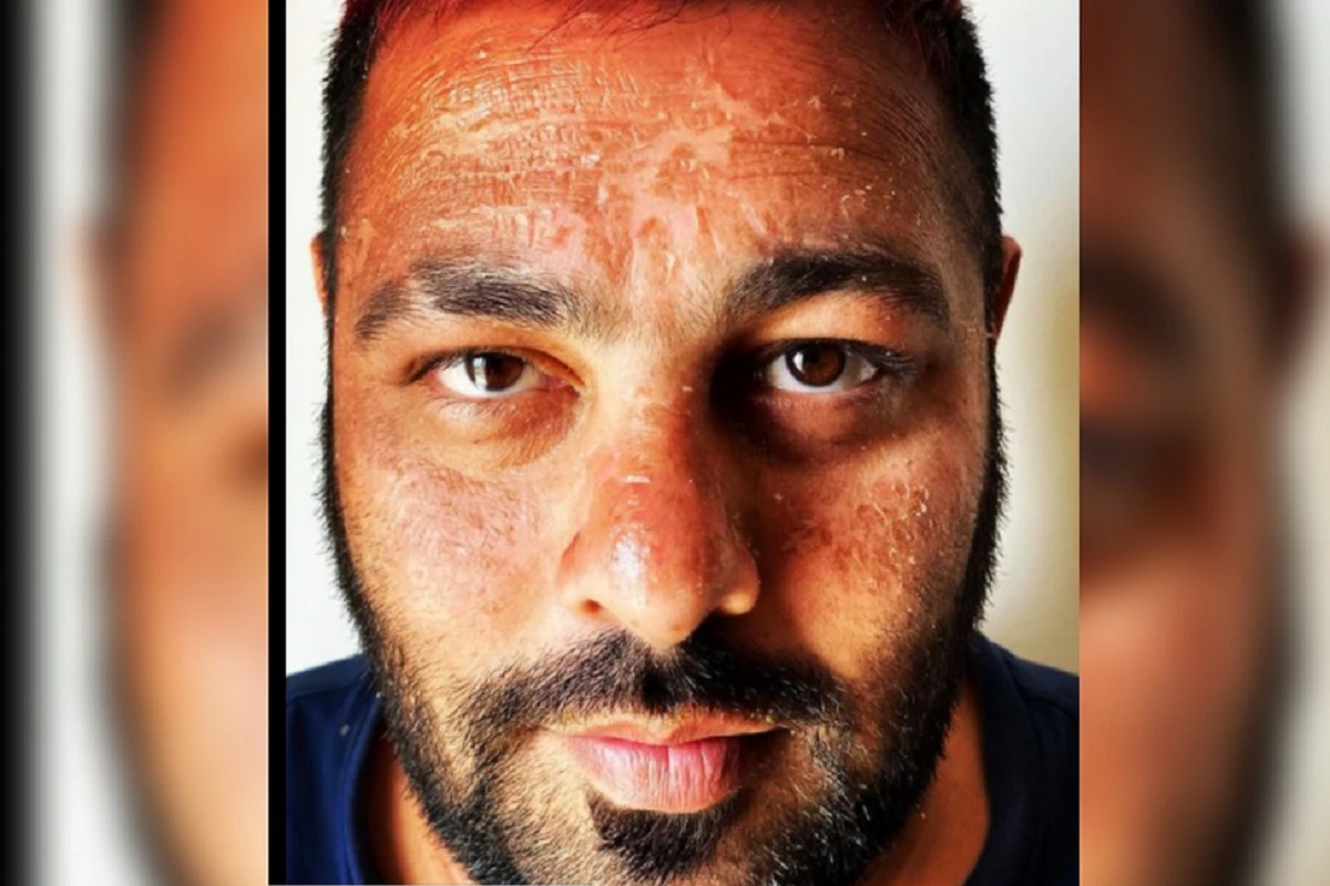 OMG! ओळखताही येणार नाही अशी झाली बादशाहच्या चेहऱ्याची अवस्था, हा PHOTO होतोय व्हायरल