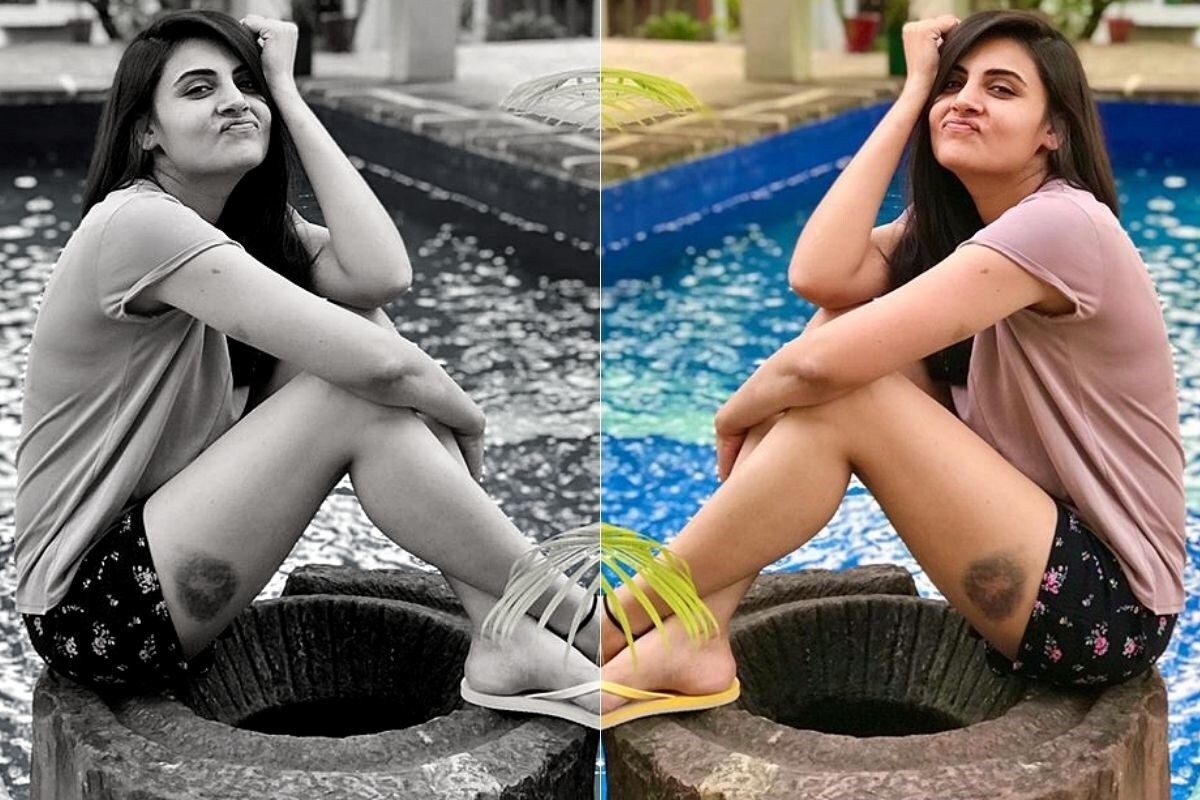 मागच्या IPL च्या सीझनमध्ये ही मिस्ट्री गर्ल पुन्हा चर्चेत आली आहे या फोटोमुळे. शूटिंगच्या दरम्यान तिला झालेल्या जखमेचा फोटो तिनेच शेअर केला आहे. मागच्या IPL च्या सीझनमध्ये ही मिस्ट्री गर्ल पुन्हा चर्चेत आली आहे या फोटोमुळे. शूटिंगच्या दरम्यान तिला झालेल्या जखमेचा फोटो तिनेच शेअर केला आहे.