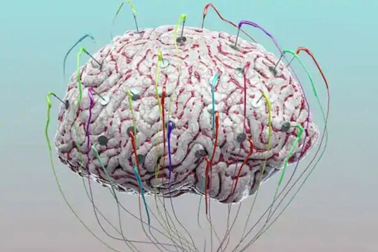 जरा प्रदूषण कमी झालं तर आणखी वाढेल तुमच्या मुलांची स्मरणशक्ती - Nitrogen Dioxide बद्दल नवा शोध
