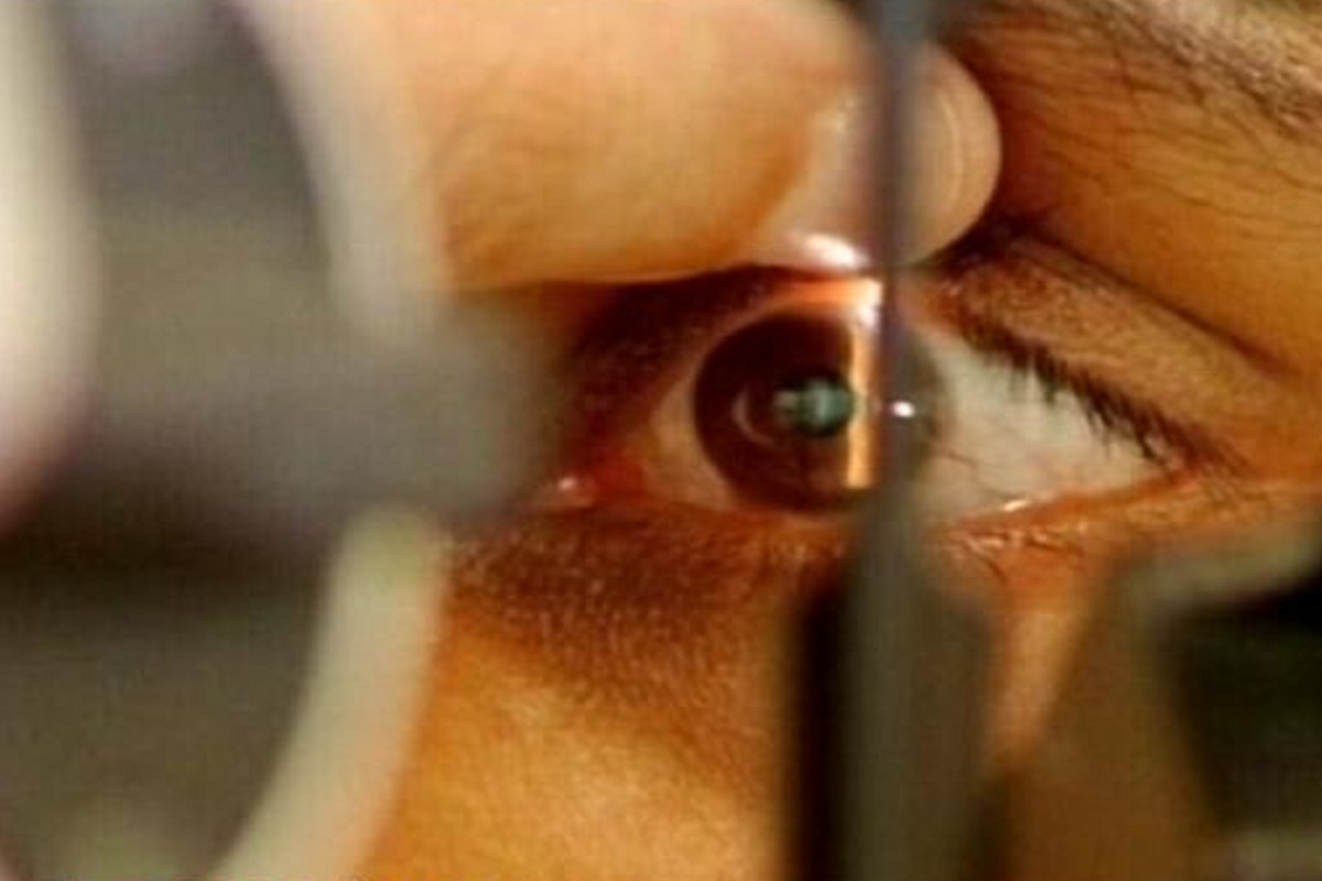 shocking! डोळा दुखू लागला म्हणून रुग्णालयात गेला; जे दिसलं ते पाहून डॉक्टरही हडबडले