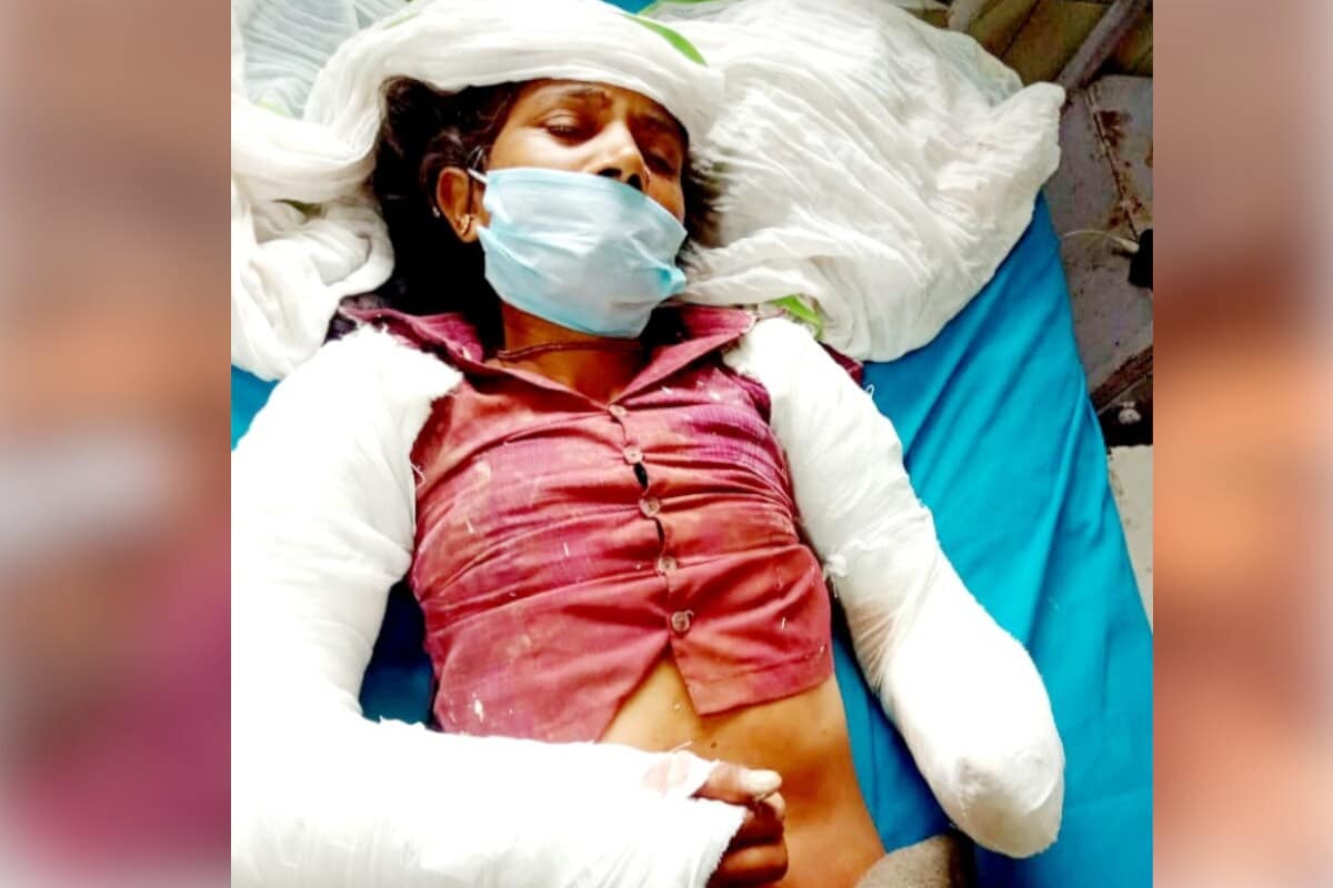 गावकऱ्यांनी दोन तास कष्ट घेतले आणि साखळीचा वापर करून महिलेची सुटका केली. ग्रामस्थांनी त्या महिलेला जिवंत बाहेर काढले. जखमी लाखो देवी यांना तातडीने करौली रुग्णालयात दाखल करण्यात आले. या महिलेच्या दोन्ही हात चिरडल्यामुळे त्यांना जयपूर येथे रेफर करण्यात आले. गावकऱ्यांनी दोन तास कष्ट घेतले आणि साखळीचा वापर करून महिलेची सुटका केली. ग्रामस्थांनी त्या महिलेला जिवंत बाहेर काढले. जखमी लाखो देवी यांना तातडीने करौली रुग्णालयात दाखल करण्यात आले. या महिलेच्या दोन्ही हात चिरडल्यामुळे त्यांना जयपूर येथे रेफर करण्यात आले.