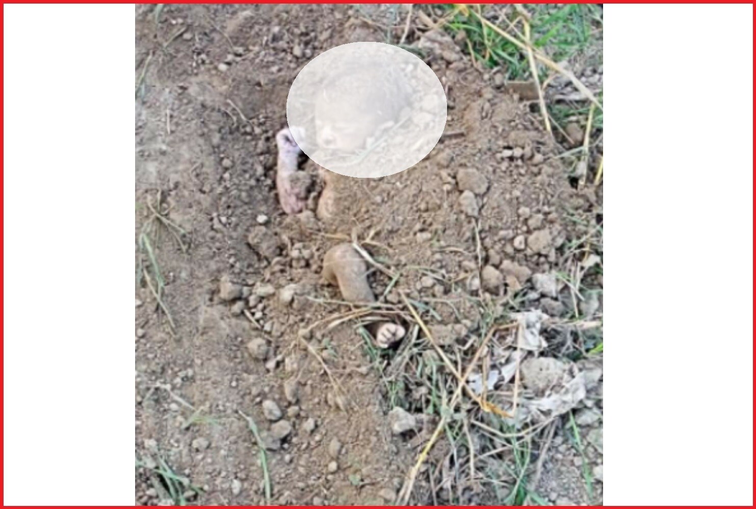 बाळाच्या नाकात, तोंडात माती गेली होती. कुंदन त्या बाळाच्या नाका-तोंडातील माती साफ करत थेट रुग्णालयाकडे निघाले. रस्त्यातच त्यांना एक रुग्णवाहिका दिसली, त्यांनी त्या बाळाला त्यांच्याकडे सोपावलं. बाळाच्या नाकात, तोंडात माती गेली होती. कुंदन त्या बाळाच्या नाका-तोंडातील माती साफ करत थेट रुग्णालयाकडे निघाले. रस्त्यातच त्यांना एक रुग्णवाहिका दिसली, त्यांनी त्या बाळाला त्यांच्याकडे सोपावलं.