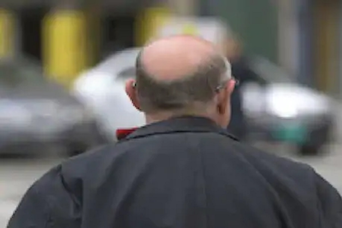 नवरा टकला म्हणून पत्नीची पोलिसात तक्रार; कोर्टानंही टक्कल पडलेल्या पतीला फटकारलं