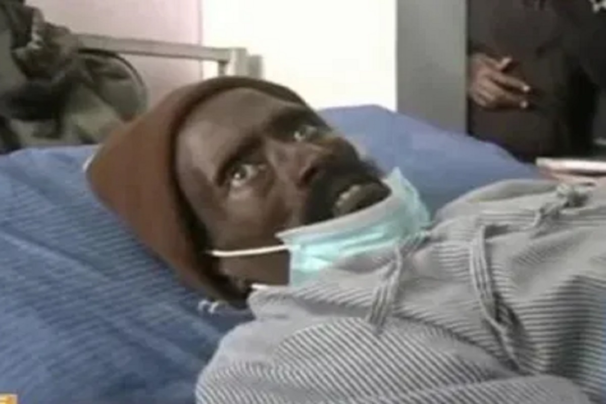 HORROR!!! पाय कापला, रक्त काढणार इतक्यात... पोस्टमॉर्टेम करता करता रडत उठला मृतदेह