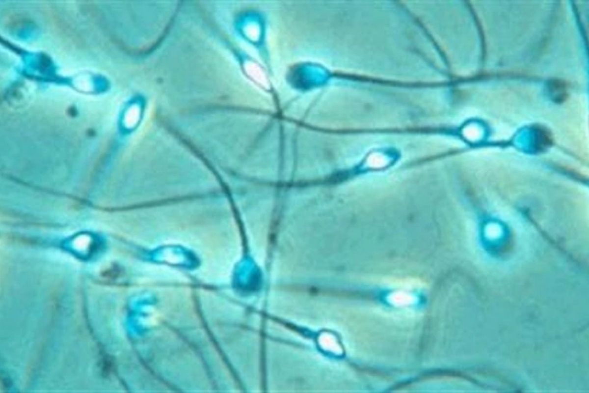 डेली मेलच्या रिपोर्टनुसार एलन स्वत: दोन मुलांचा बाबा आहे. मात्र त्याने खासगी स्वरुपात स्पर्म डोनेट करुन तब्बल 23 मुलांना जन्म दिला आहे. तो रजिस्टर्ड फर्टिलिटी सेंटरमध्येही स्पर्म डोनेल करतो. डेली मेलच्या रिपोर्टनुसार एलन स्वत: दोन मुलांचा बाबा आहे. मात्र त्याने खासगी स्वरुपात स्पर्म डोनेट करुन तब्बल 23 मुलांना जन्म दिला आहे. तो रजिस्टर्ड फर्टिलिटी सेंटरमध्येही स्पर्म डोनेल करतो.