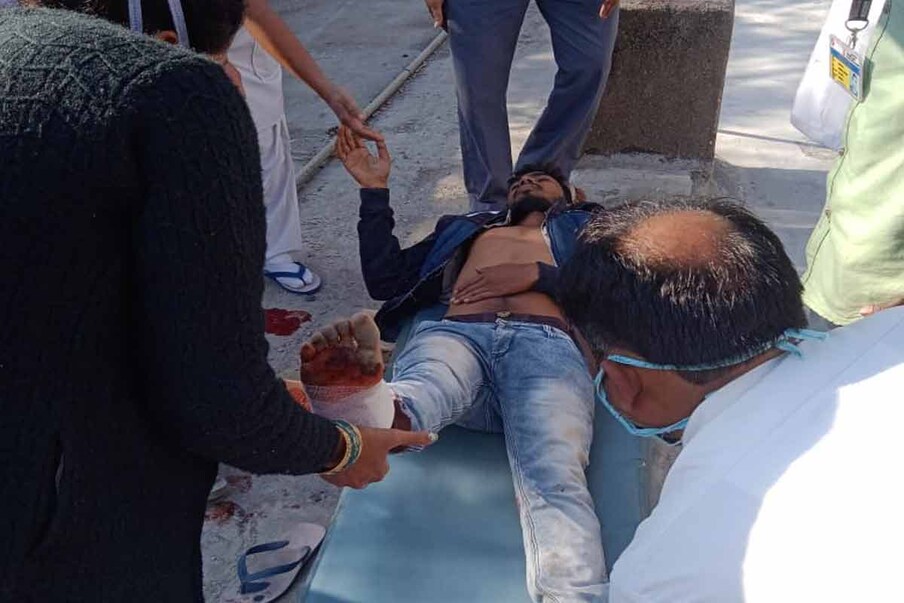 जखमी कर्मचाऱ्यांना रेल्वे रुग्णालयातच दाखल करण्यात आले असून त्यांच्यावर उपचार सुरू आहेत.