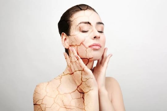 हाय ब्लड शुगर लेव्हलचा त्रास असेल तर, सतत लघवी येत राहते. याशिवाय थकवा येणं, सतत तहान लागणं, स्कीन ड्राय होऊन खाज येणं, इन्फेक्शन होणं हे त्रास देखील होत राहतात. वजन वाढीचा त्रास असणाऱ्या लोकांमध्ये ब्लड शुगर लेव्हल हाय होऊन डायबिटीस होण्याचा धोकाही जास्त असतो.