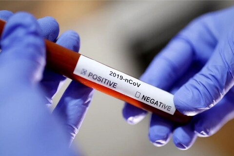 कोरोनाची चाचणी (Corona Test) करण्यासाठी आता हॉस्पिटलमध्ये (Hospital) किंवा लॅबमध्ये (Lab) जाण्याची गरज नसून घरच्या घरी ही टेस्ट करणं भारतीयांना शक्य होणार आहे.