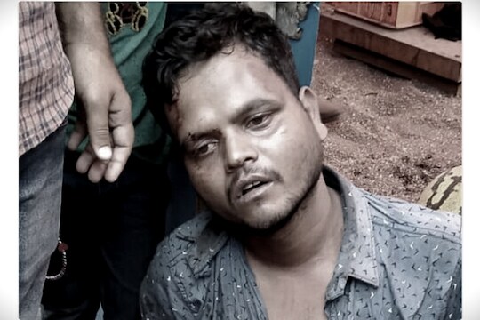 VIDEO: महिलेनं पतीला टेम्पोला बांधून एक किलोमीटर फरफटत नेलं, घटना CCTV मध्ये कैद