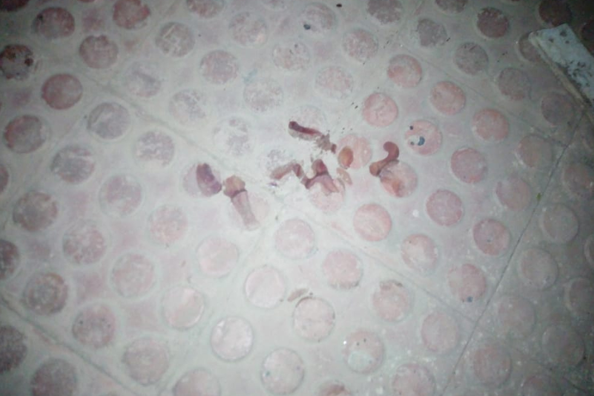 पुणेरी माणसाच्या हिंमतीला नाही तोड, चाकू लागल्यानंतरही रक्ताने लिहून ठेवला पुरावा