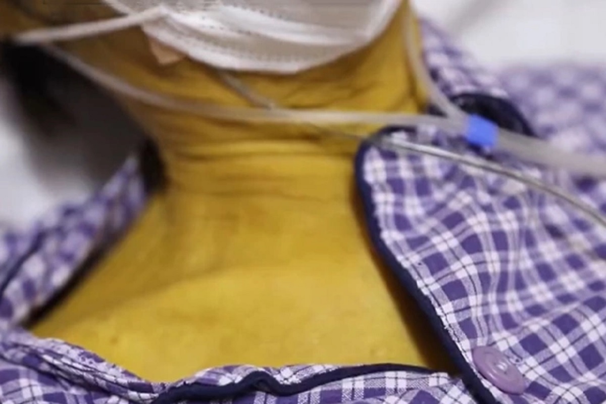 फोटो सौजन्य - AsiaWire