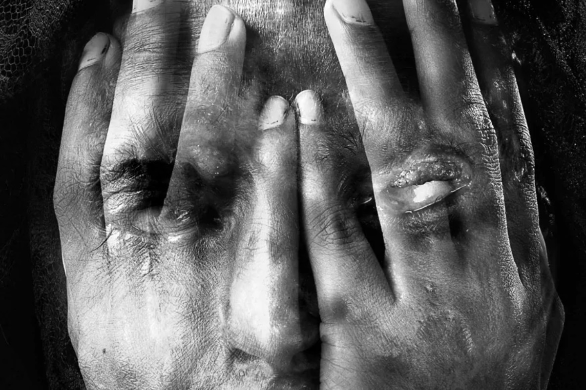 बापरे! चक्क तरुणीनं प्रियकरावर केला अॅसिड हल्ला, घटनेत युवकाचा मृत्यू